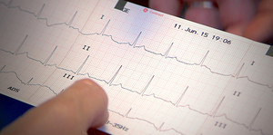 Be professional on reading ECG