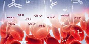 Basic Guideline To Antibody Identification