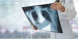 Clinical approach to Chest X-ray with a real scinarios.