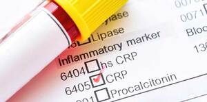 Inflammatory markers for general practitioners