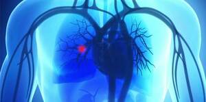 Role of Echocardiography in Acute Pulmonary Embolism