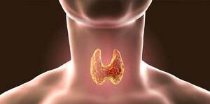 Thyroid disorders