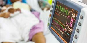 Basics of Mechanical Ventilation