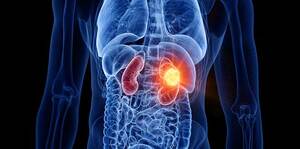 Cystic kidney disease