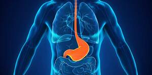 Peptic Ulcer Disease