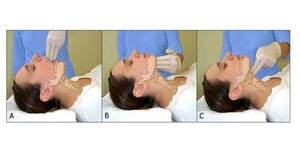Airway Assessment and Management