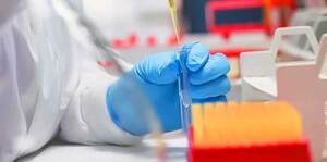 Internal And External Proficiency Testing Program