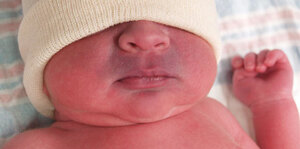 Management of Neonatal Cyanosis, Management of a Child with Syncope