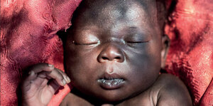 Management of Neonatal Fever