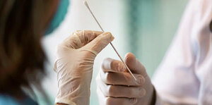 Diagnosis of COVID-19