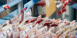 Blood supply management during pandemics, one center experience in the age of COVID-19