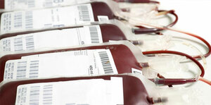 Immunohematology and Blood Product Management