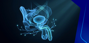 Diabetic Neuropathy: Dx & Rx