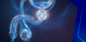 Management of cognitive impairment among elderly