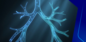 It is not always Asthma ?