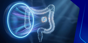 Colon Cancer Screening