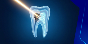  Prevention and reversal of degenerative dental diseases: Lifestyle, systemic health and aging considerations Chapter 6