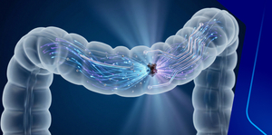 Updated Guidelines in Treatment of Advanced Colon Cancer